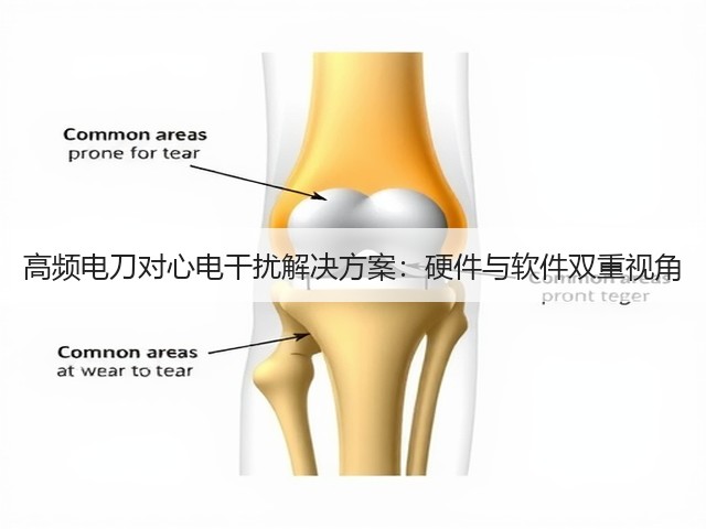 高频电刀对心电干扰解决方案：硬件与软件双重视角(图3)